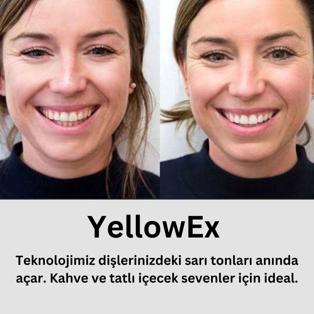 YellowEx - Köpük